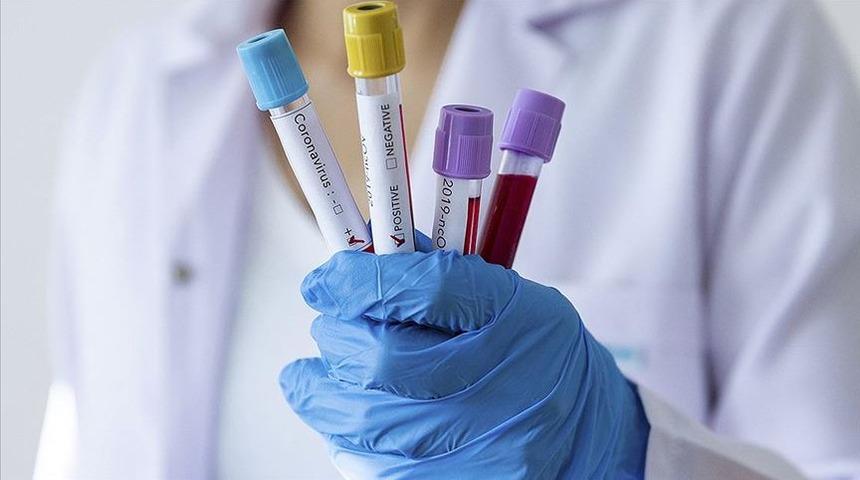 KKTC’ye karantinasız 3 günlük girişler durduruldu