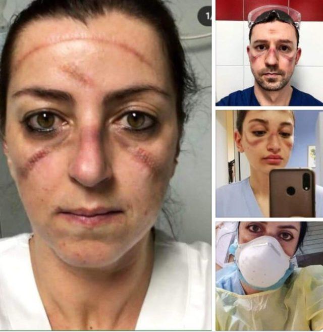 Koronavirüsün korkunç gerçekliği! Sağlık çalışanları: Yalvarıyoruz evde kalın 1