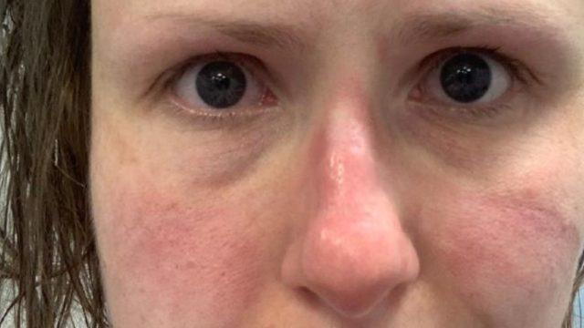 Koronavirüsün korkunç  gerçekliği! Sağlık çalışanları: Yalvarıyoruz evde kalın