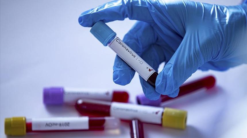 Ticaret Bakanlığı personeli koronavir&uuml;se yakalandı