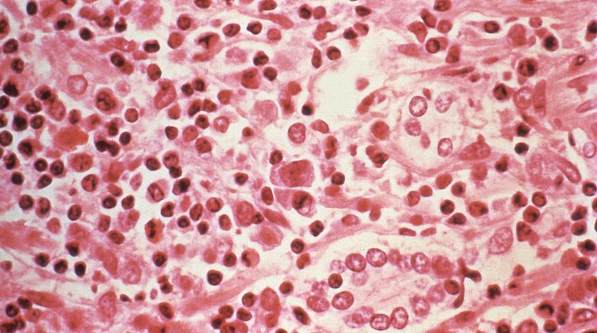 Koronavir&uuml;s salgını bitmeden şimdi de hantavir&uuml;s salgını mı?