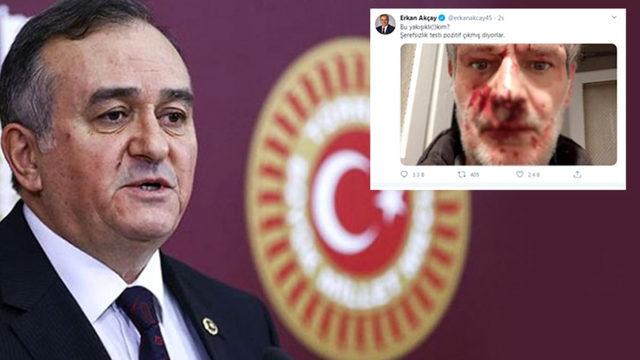 MHP Grup Başkanvekili Erkan Akçay'ın paylaşımı olay oldu!