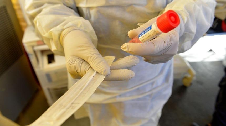 T&uuml;rkiye'de hangi kriterlere g&ouml;re koronavir&uuml;s testi yapılıyor, sayı yeterli mi?