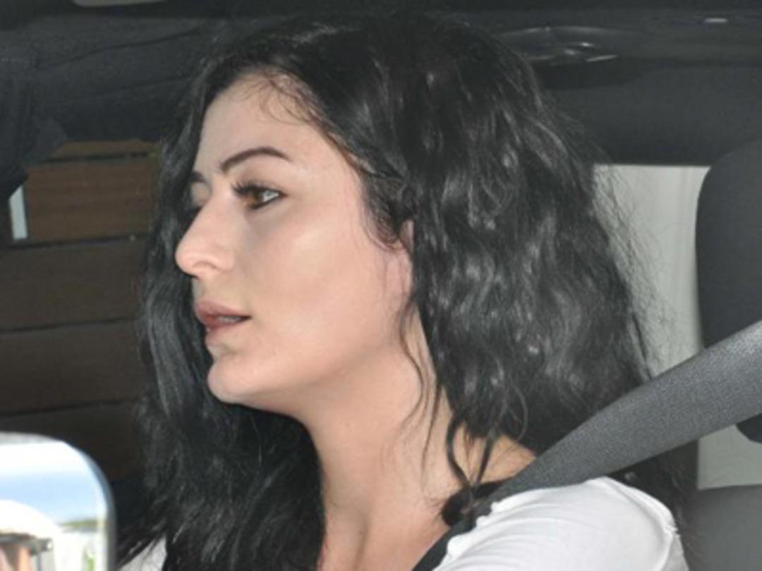 Deniz &Ccedil;akır estetik mi yaptırdı?