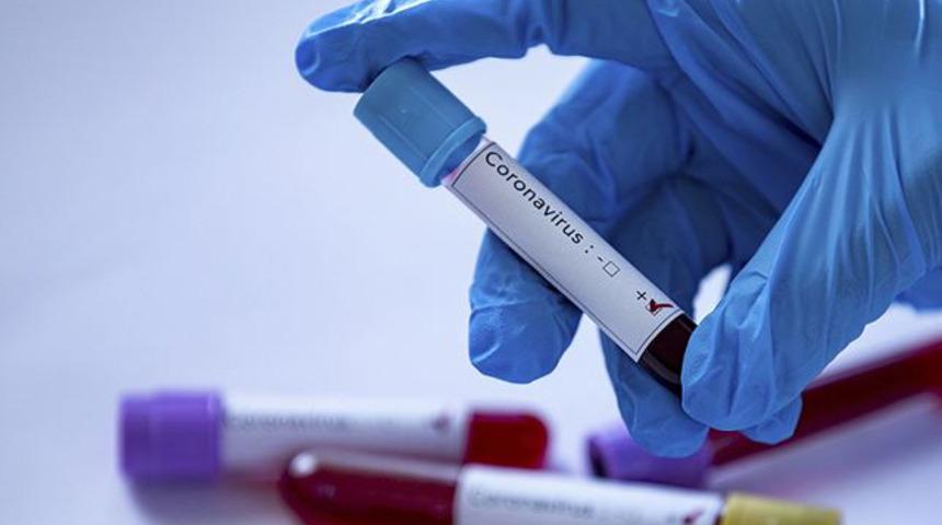 T&uuml;rkiye'de koronavir&uuml;s tehdidi ne zaman ortadan kalkacak? Bilim Kurulu &uuml;yesi a&ccedil;ıkladı