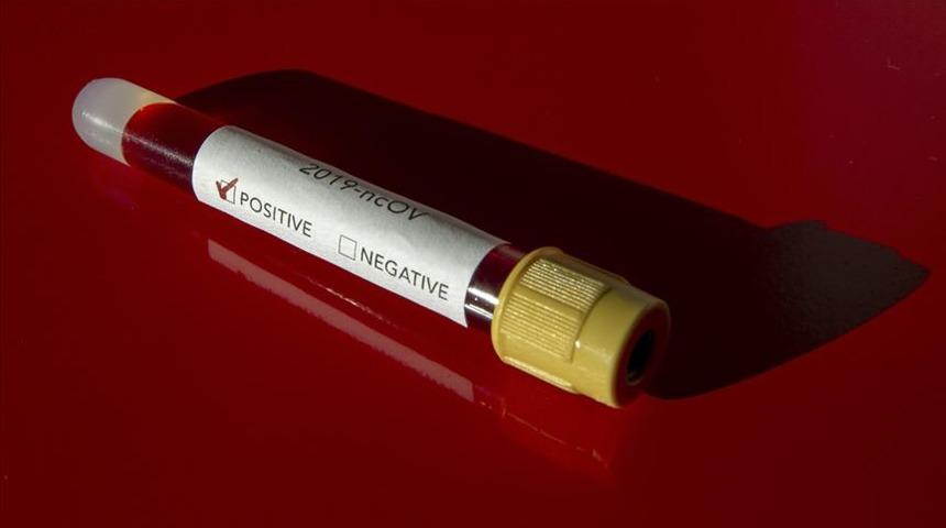 Bakanlık hazırladı! İşte 65 yaş &uuml;st&uuml; vatandaşları koronavir&uuml;se karşı koruyacak 19 &ouml;neri