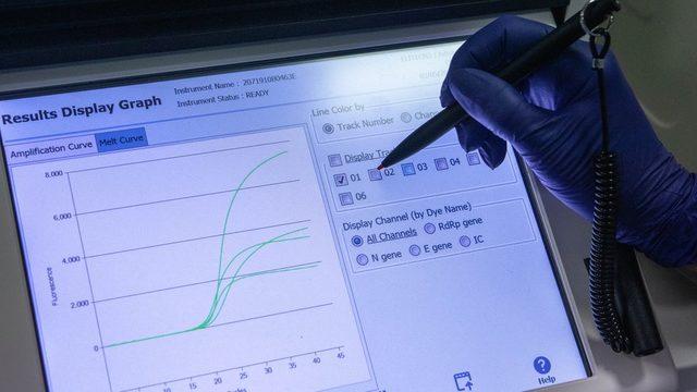 Koronavirüs test sonuçları