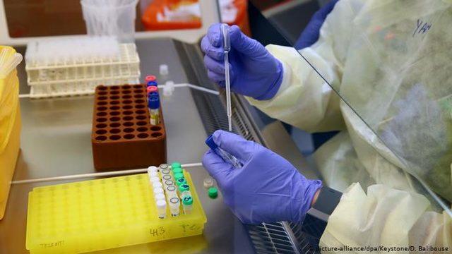 Bosch hızlı koronavirüs testi geliştirdi