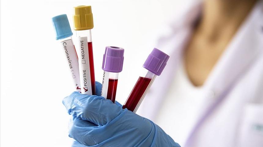 KKTC&rsquo;de koronavir&uuml;s nedeniyle k&ouml;yler karantinaya alındı