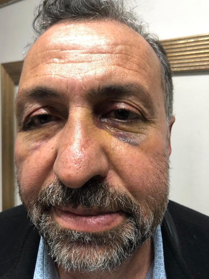 Ankara’da film gibi dükkan baskını! Saatlerce izleyip 12 kişiyle gittiler G5