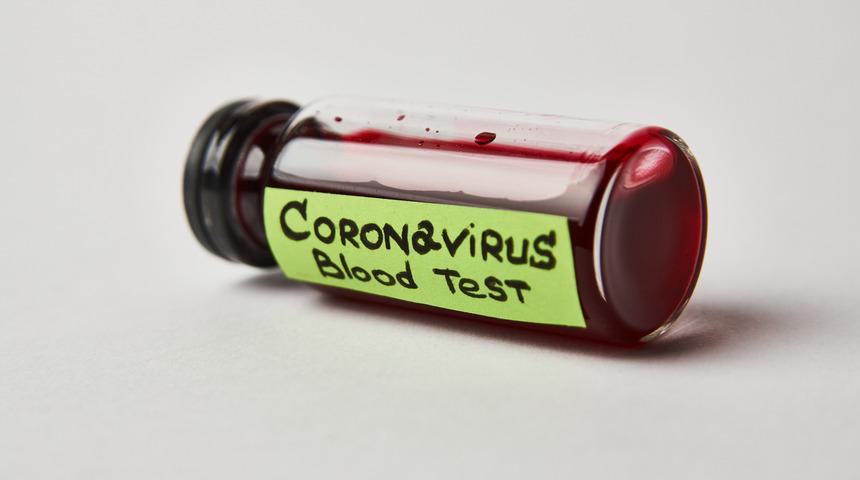 Kovid-19 diyabet hastalarında daha ağır seyrediyor