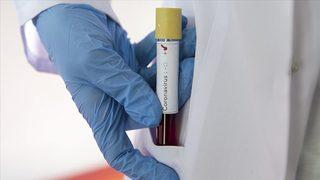 Uruguay'da koronavirüs nedeniyle ilk can kaybı