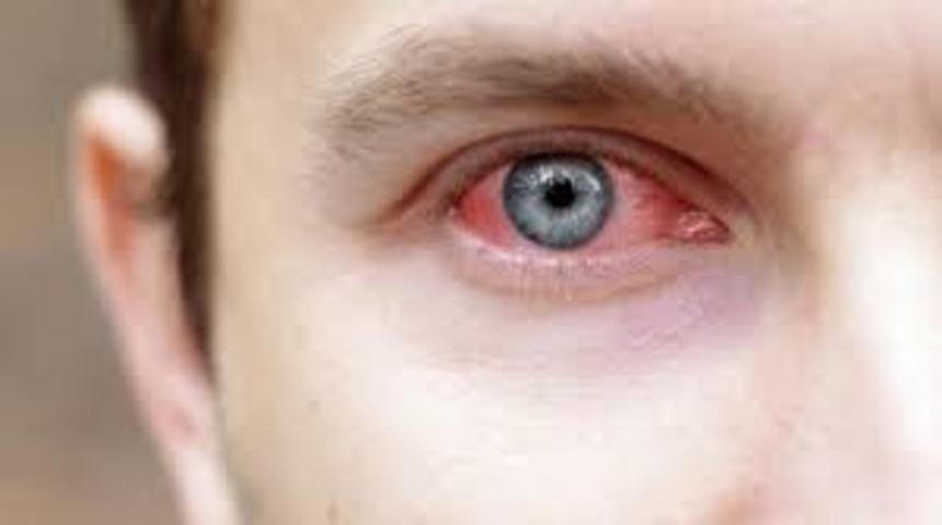  Koronavir&uuml;s&uuml;n bug&uuml;ne kadar bilinmeyen yeni bir belirtisi keşfedildi