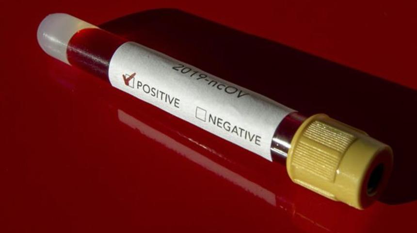 Prof. Dr. Y&uuml;cel Oğurlu: Koronavir&uuml;s&uuml; bilerek bulaştıran kasten adam &ouml;ld&uuml;rm&uuml;ş olabilir