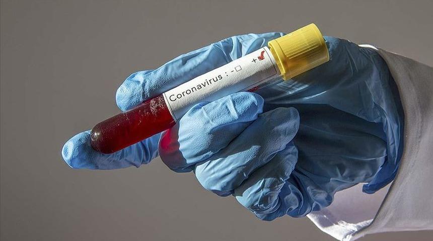 Sağlık Bakanlığı duyurdu! 44 ilde 73 merkez 'Kovid-19 Tanı Laboratuvarı' oldu