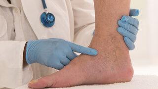 Anne-babadan geçiyor! Varis tedavi edilmezse öldürüyor