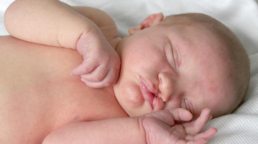 Damak yarığı ameliyatı sonrası oluşabilen fist&uuml;l sorunu ve tedavisi