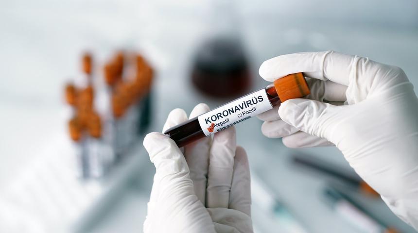 ABD'li uzmanlardan koronavirüsün bulaşıcılığıyla ilgili yeni uyarılar