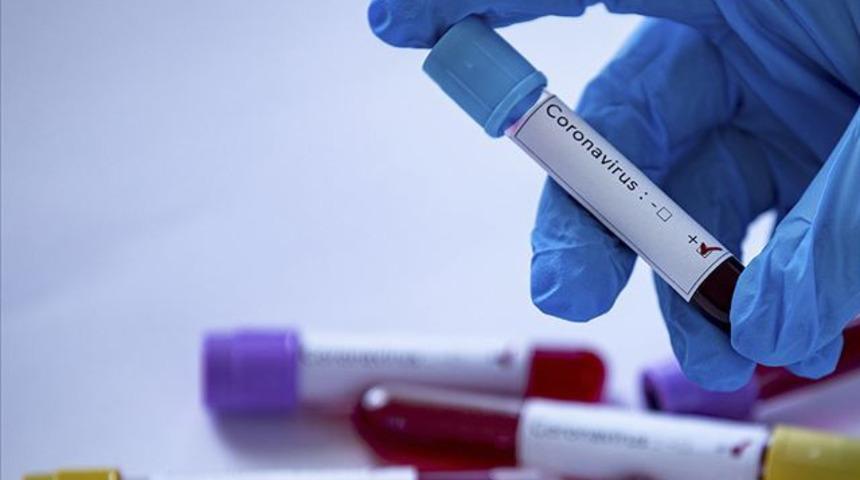 Koronavirüsü hangi özel sağlık sigorta şirketleri kapsıyor?