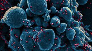 Korkutan iddia: Koronavirüs kısır mı yapıyor?