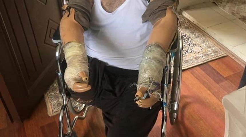 Başkan Şayir, kolunu ve bacağını kaybeden vatandaşın y&uuml;z&uuml;n&uuml; g&uuml;ld&uuml;rd&uuml;