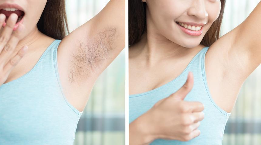 Koltuk altı t&uuml;ylerini azaltmak i&ccedil;in doğal karışımlar! Limon, bal, zencefil...