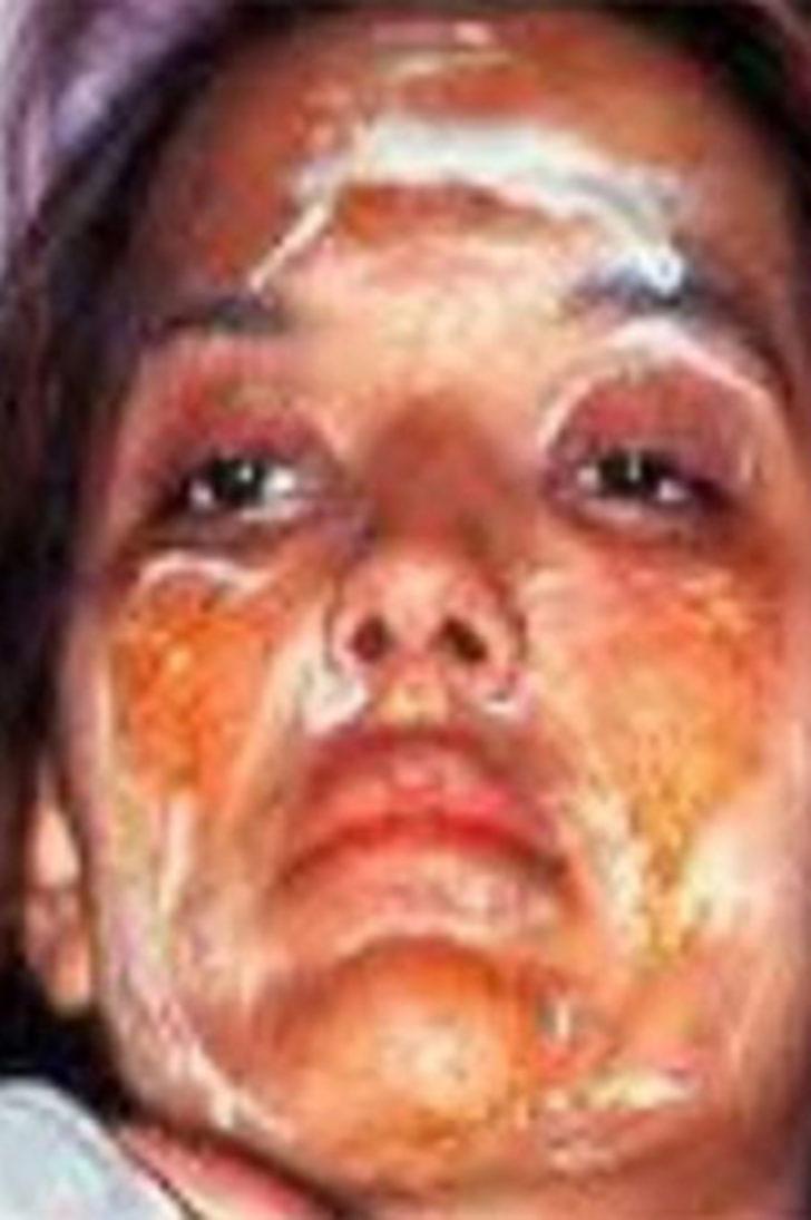 Demet Akalın hayranlarını korkuttu G1