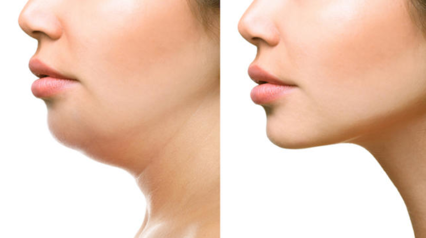 Estetiğe gerek yok! Bu y&ouml;ntem gıdıyı yerle bir ediyor! 