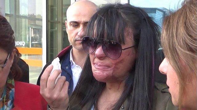 Asitli saldırıya uğrayan Berfin Özek: Ozan'a hakkımı helal ettim