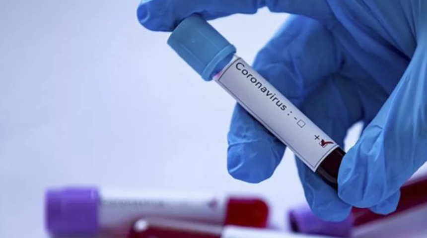 Koronavir&uuml;s salgınında son durum! Vir&uuml;s yayılmaya devam ediyor, &ouml;l&uuml; sayısı y&uuml;kseliyor