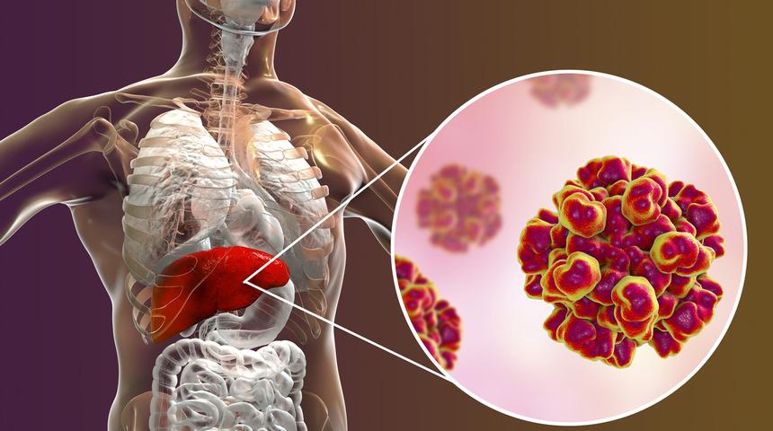 Karaciğerinizi günde 3 fincan kahveyle koruyun
