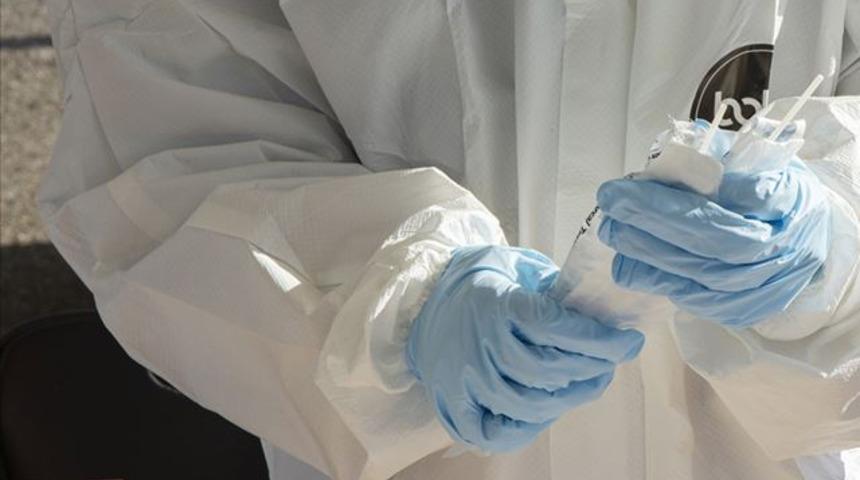 Koronavir&uuml;s tedavisinde umut veren gelişme! 