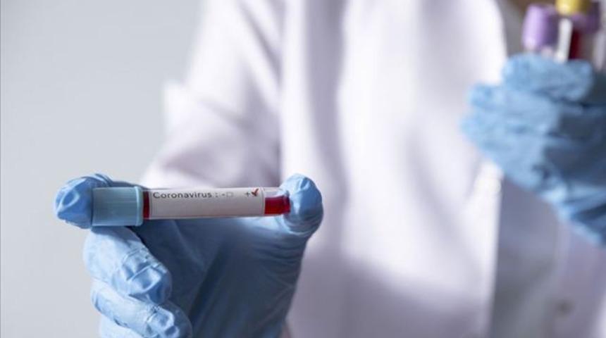 Türkiye de aralarında bulunuyor! Koronavirüsün genetik şifreleri böyle çözülecek