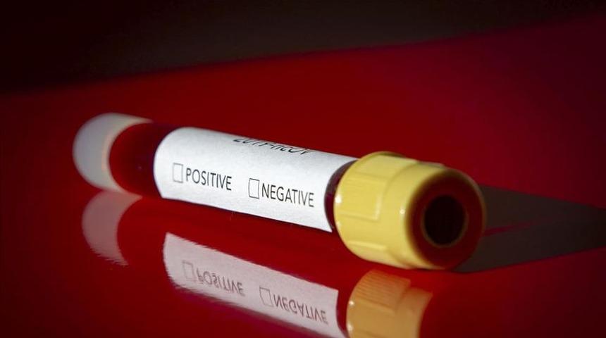 Kovid-19 taşıyan 4 yolcu şehirler arası otob&uuml;sten indirilerek hastaneye sevk edildi