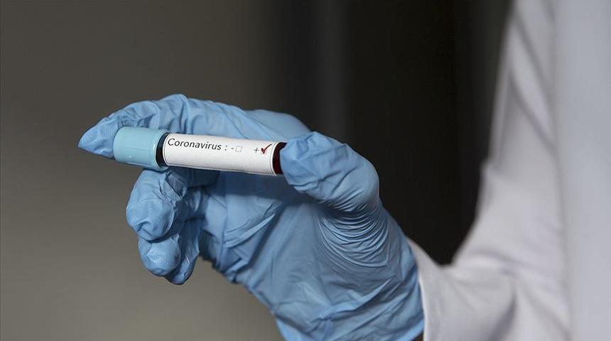 Brezilya'da koronavir&uuml;s ila&ccedil; testinde denekler &ouml;ld&uuml;, test yarıda kesildi