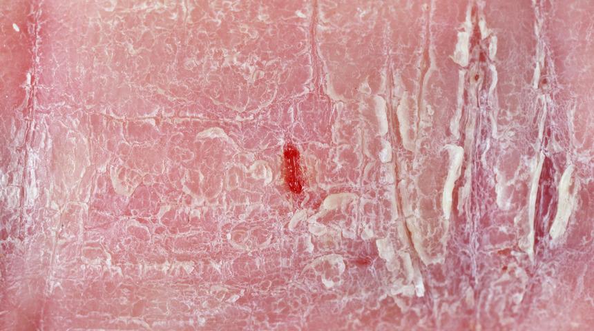 Kuru eller için evde uygulayabileceğiniz 4 bakım önerisi