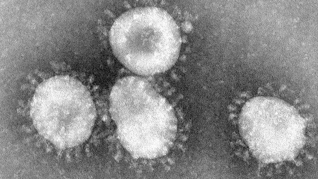 Koronavirüslerinn çevresinde taç görüntüsü var.