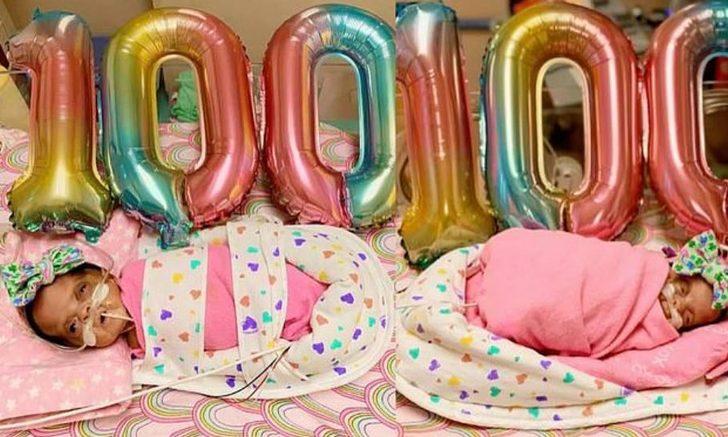 Dünyanın en prematüre ikizleri doğdu! G2