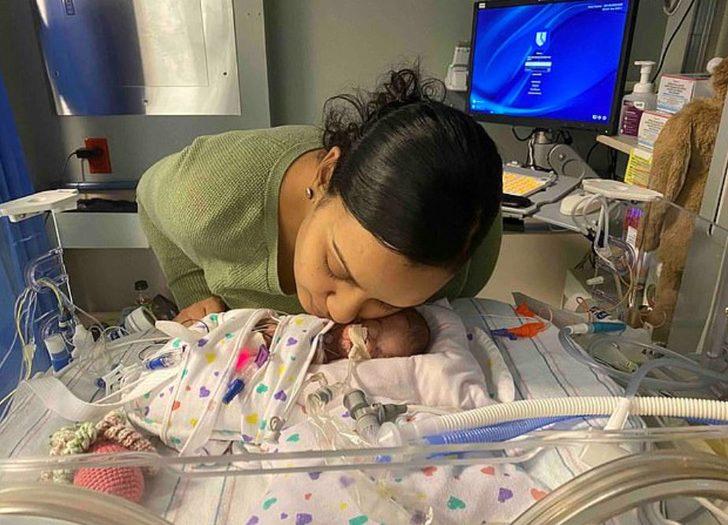 Dünyanın en prematüre ikizleri doğdu! G3