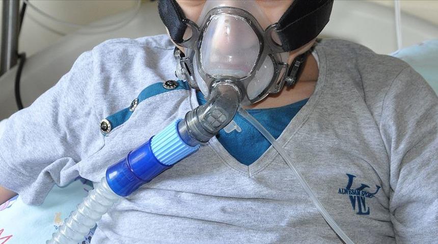 Kistik Fibrozis nedir? Koronavirüs ile ilişkisi nedir? 