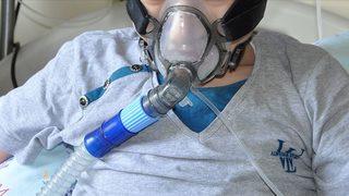 Kistik Fibrozis nedir? Koronavirüs ile ilişkisi nedir? 