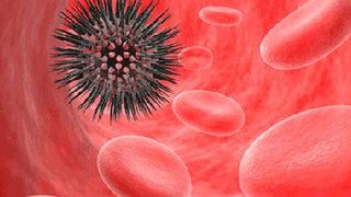 Lenfoma nedir, belirtileri nelerdir? Ebru Şallı’nın lenfoma hastası oğlu Pars, yaşamını yitirdi!  