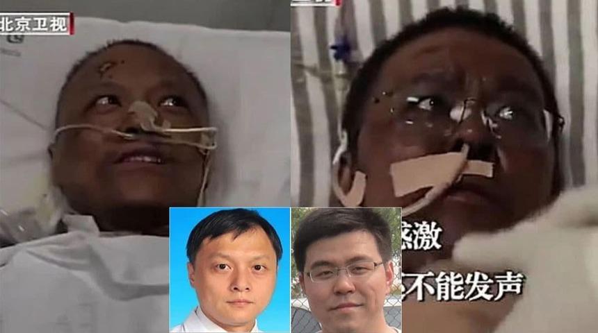  Koronavirüsü yenen doktorların ten rengi değişti