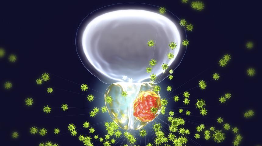 Prostat kanserinde erken tanı kolaylaştı
