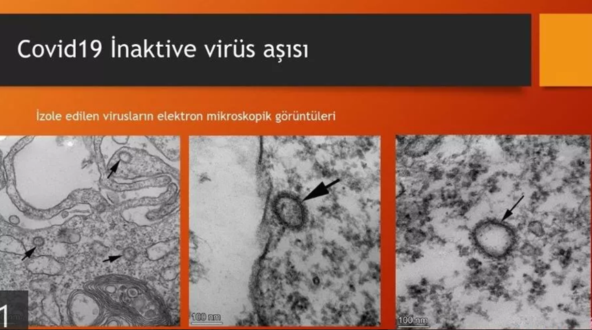 23 Nisan'ı işaret etmişti! Prof. Dr. Erc&uuml;ment Ovalı'dan aşı a&ccedil;ıklaması