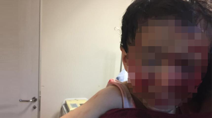 Viranşehir'de köpek saldırısına uğrayan 6 yaşındaki Davut hayatını kaybetti