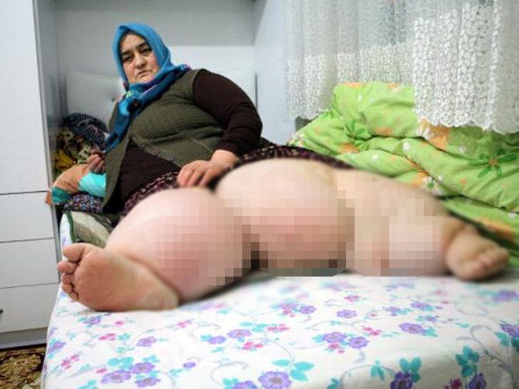 4 yıldır evden çıkamıyor! Geçirdiği kaza sonrası yatağa bağımlı hale geldi G5