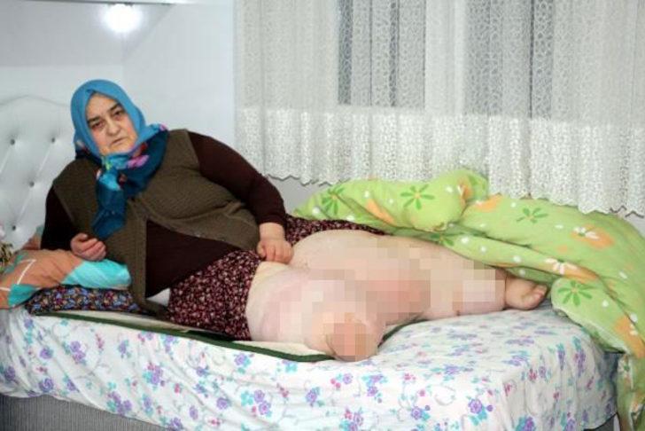 4 yıldır evden çıkamıyor! Geçirdiği kaza sonrası yatağa bağımlı hale geldi G4