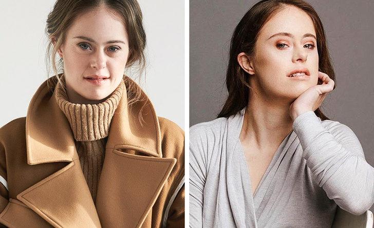 Down sendromlu model, güzelliğinizi yalnızca sizin tanımlayacağınızı kanıtladı G5