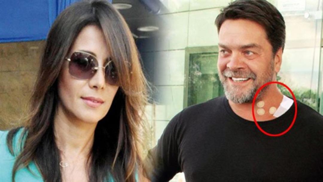 Beyaz ameliyat masasına yattı